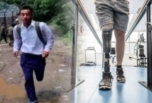 Parvez-will-soon-get-prosthetic-leg